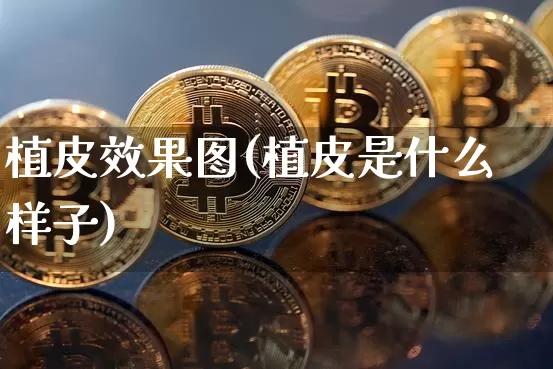 植皮效果图(植皮是什么样子)_https://www.jnskb.com_装修流程_第1张